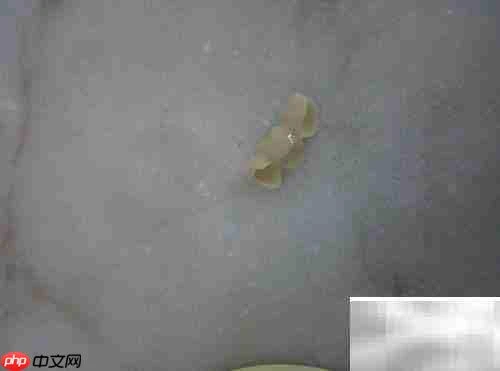 固定义齿与活动义齿对比