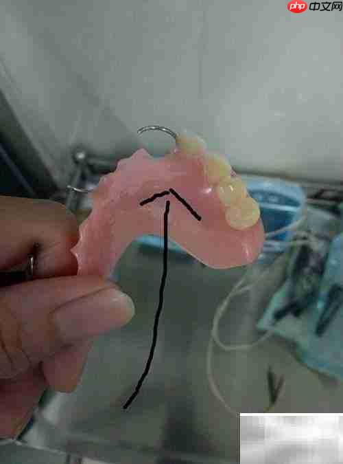 固定义齿与活动义齿对比