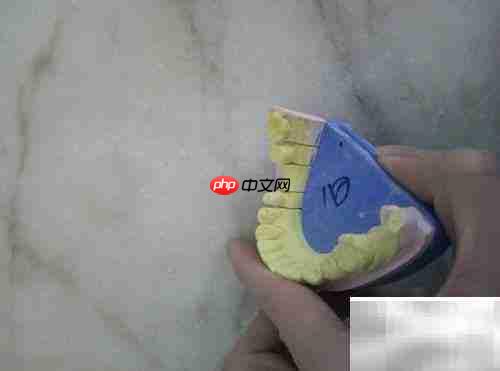 固定义齿与活动义齿对比